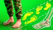 Берут ли в армию с плоскостопием? Все о степенях и категориях годности